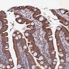 Immunohistochemical staining of human small intestine shows high expression.