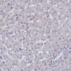 Immunohistochemical staining of human liver shows low expression as expected.