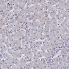 Anti-CHST5 Antibody