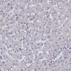 Immunohistochemical staining of human liver shows low expression as expected.