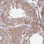 Immunohistochemical staining of human testis shows moderate cytoplasmic positivity in cells in seminiferous ducts and leydig cells.