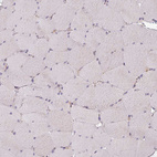 Immunohistochemical staining of human skeletal muscle shows very weak cytoplasmic positivity in myocytes.