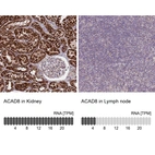 Anti-ACAD8 Antibody