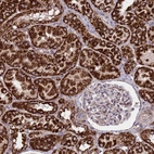 Immunohistochemical staining of human kidney shows strong granular cytoplasmic positivity in cells in tubules.