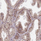 Immunohistochemical staining of human prostate shows moderate granular cytoplasmic positivity in glandular cells.