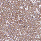 Immunohistochemical staining of human liver shows moderate granular cytoplasmic positivity in hepatocytes.
