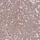 Immunohistochemical staining of human liver shows moderate granular cytoplasmic positivity in hepatocytes.