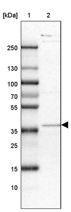 Lane 1: Marker [kDa] 250, 130, 100, 70, 55, 35, 25, 15, 10_br/_Lane 2: Human cell line HEL