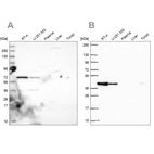 Western blot analysis using Anti-GIPC1 antibody HPA043958 (A) shows similar pattern to independent antibody HPA061786 (B).