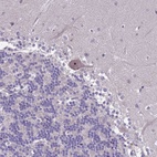 Anti-ZNF333 Antibody