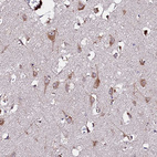Immunohistochemical staining of human cerebral cortex shows strong cytoplasmic positivity in neurons.