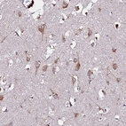 Immunohistochemical staining of human cerebral cortex shows strong cytoplasmic positivity in neurons.