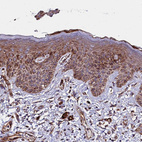 Immunohistochemical staining of human skin shows strong cytoplasmic positivity in squamous epithelial cells.