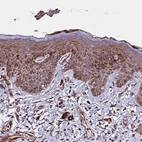 Immunohistochemical staining of human skin shows strong cytoplasmic positivity in squamous epithelial cells.