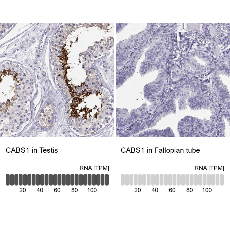 Anti-CABS1 Antibody
