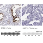 Anti-CABS1 Antibody