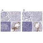 Immunohistochemical staining of human kidney, liver, lymph node and testis using Anti-CABS1 antibody HPA044016 (A) shows similar protein distribution across tissues to independent antibody HPA055352 (B).