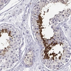 Immunohistochemical staining of human testis shows high expression.