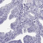 Immunohistochemical staining of human fallopian tube shows low expression as expected.