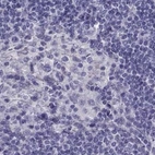 Immunohistochemical staining of human lymph node using Anti-CABS1 antibody HPA044016.