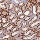 Immunohistochemical staining of human kidney shows strong granular cytoplasmic positivity in cells in tubules.