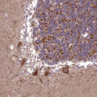 Immunohistochemical staining of human cerebellum shows strong granular cytoplasmic positivity in Purkinje cells.
