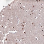 Anti-THOC7 Antibody