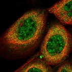 Immunofluorescent staining of human cell line A-431 shows localization to nuclear speckles & cytosol.