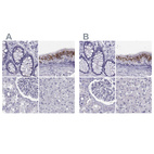 Immunohistochemical staining of human colon, epididymis, kidney and liver using Anti-RNASE12 antibody HPA044175 (A) shows similar protein distribution across tissues to independent antibody HPA059465 (B).