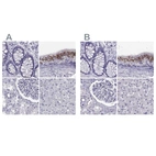 Immunohistochemical staining of human colon, epididymis, kidney and liver using Anti-RNASE12 antibody HPA044175 (A) shows similar protein distribution across tissues to independent antibody HPA059465 (B).