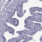 Immunohistochemical staining of human fallopian tube shows low expression as expected.