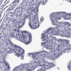 Immunohistochemical staining of human fallopian tube shows low expression as expected.