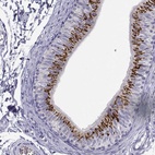 Immunohistochemical staining of human epididymis shows high expression.