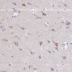 Anti-DNAJA3 Antibody