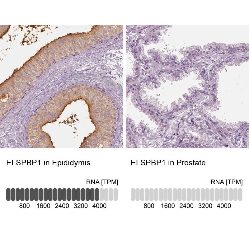 Anti-ELSPBP1 Antibody