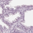 Immunohistochemical staining of human prostate shows no positivity in glandular cells as expected.