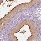 Immunohistochemical staining of human epididymis shows moderate cytoplasmic positivity in glandular cells.