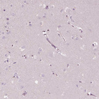 Immunohistochemical staining of human cerebral cortex shows no positivity in neurons as expected.