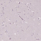 Immunohistochemical staining of human cerebral cortex shows no positivity in neurons as expected.
