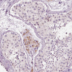 Immunohistochemical staining of human testis shows moderate cytoplasmic positivity in Leydig cells.