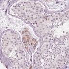 Immunohistochemical staining of human testis shows moderate cytoplasmic positivity in Leydig cells.