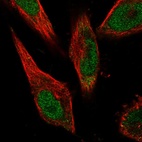 Immunofluorescent staining of human cell line U-251 MG shows localization to nucleoplasm & cytosol.