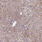 Immunohistochemical staining of human liver shows moderate cytoplasmic positivity in hepatocytes.