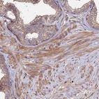 Immunohistochemical staining of human prostate shows moderate cytoplasmic positivity in smooth muscle cells.