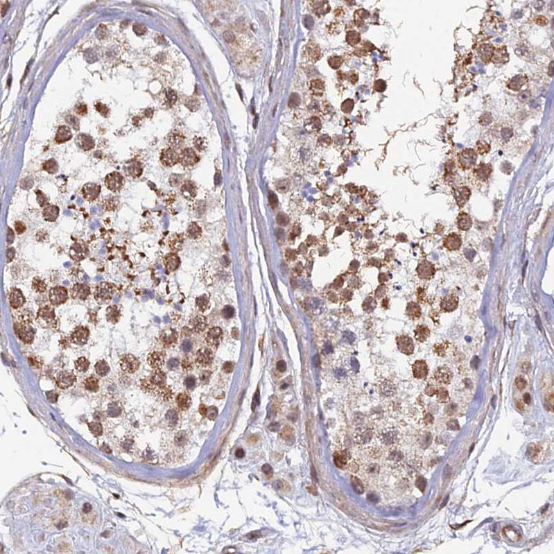 Anti-XKR9 Antibody