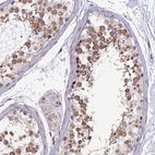 Anti-XKR9 Antibody