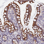 Anti-MROH1 Antibody