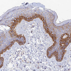 Immunohistochemical staining of human skin shows strong cytoplasmic positivity in basal squamous epithelial cells.