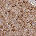 Anti-MROH1 Antibody