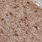 Immunohistochemical staining of human cerebral cortex shows strong cytoplasmic positivity in glial cells.